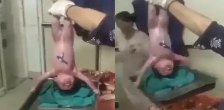نومولود نے پیدا ہوتے ہی ٹرے اٹھا لیا، حیرت انگیز ویڈیو وائرل