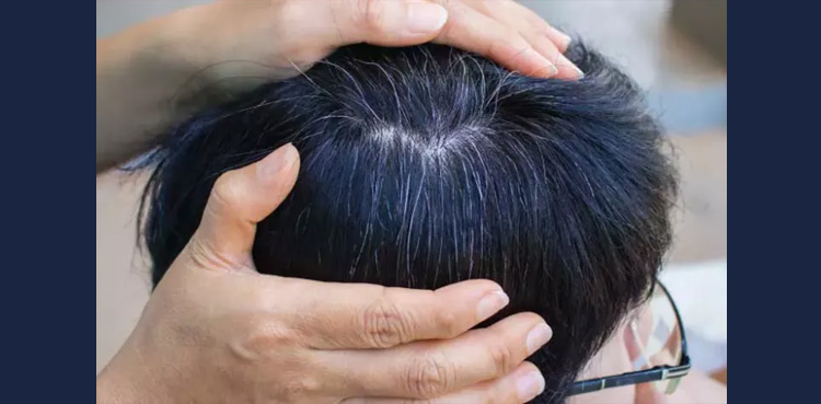 بچوں کے سفید بال اور ان کا آسان علاج، بہترین ٹوٹکہ