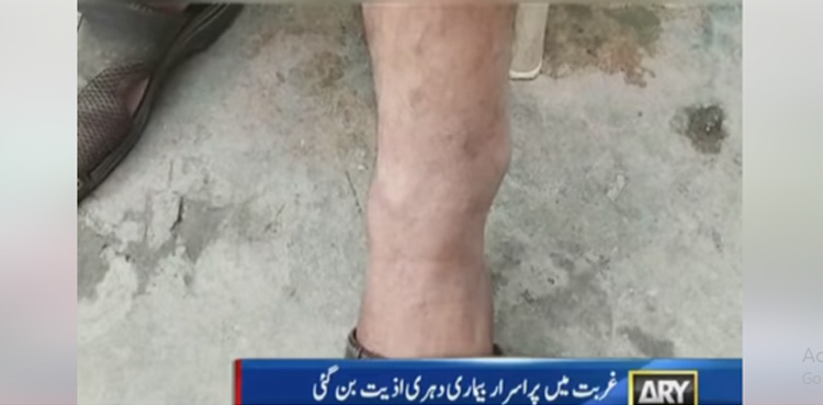 غریب درزی پراسرار بیماری کا شکار