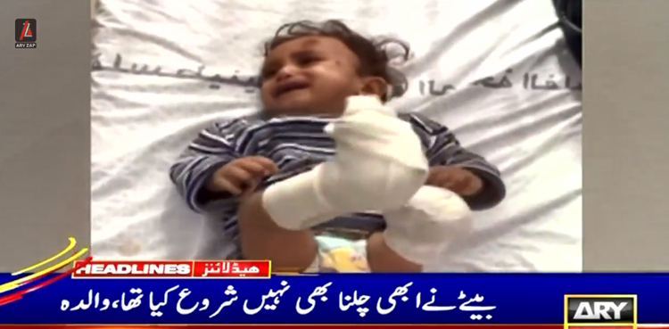 اسرائیلی درندوں نے 9 ماہ کے احمد کو زندگی بھر کیلئے معذور کردیا