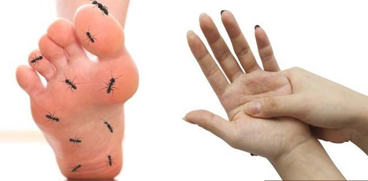 کیا ہاتھ پیروں میں سُوئیاں چبھتی محسوس ہوتی ہیں؟