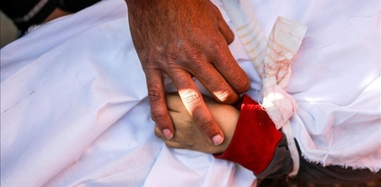 غزہ میں غذائی قلت نے 6 بچوں کی جانیں لے لی