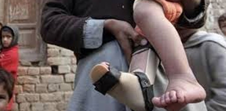 ملک سے پولیو وائرس ختم نہ ہونے کی وجوہات سامنے آگئیں