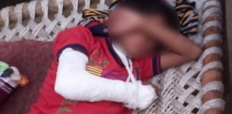 بھارت، نچلی ذات کے چوتھی جماعت کے طالبعلم پر ٹیچر کا بدترین تشدد