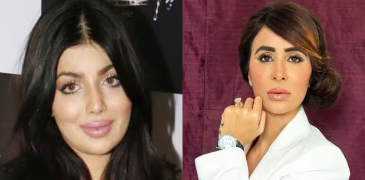 عائشہ ٹاکیہ کی پلاسٹک سرجری کس وجہ سے خراب ہوئی؟ ڈاکٹر نے بتادیا