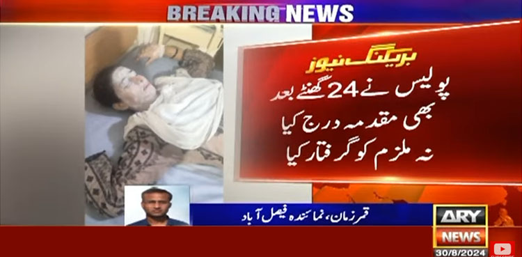 فیصل آباد میں خاتون پر کیمیل پھینک دیا گیا، چہرہ جھلس گیا