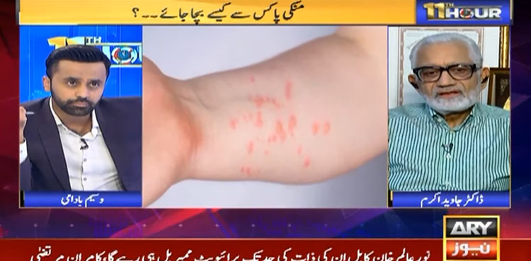 منکی پاکس سے خوف و ہراس میں مبتلا ہونے کی کوئی ضرورت نہیں، ڈاکٹر جاوید