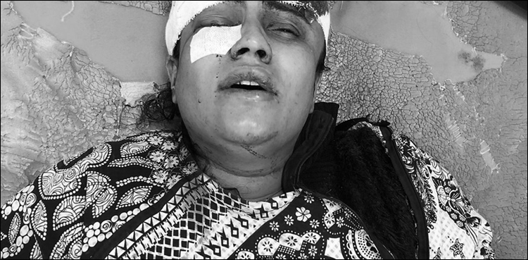 خلع کا دعویٰ کیا ہے، شوہر اور اپنے ہی بیٹوں کے ہاتھوں لہولہان خاتون کی حالت خراب