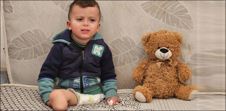 غزہ میں اب تک ڈاکٹروں نے زخمیوں کے کتنے ہزار ہاتھ پیر کاٹے؟