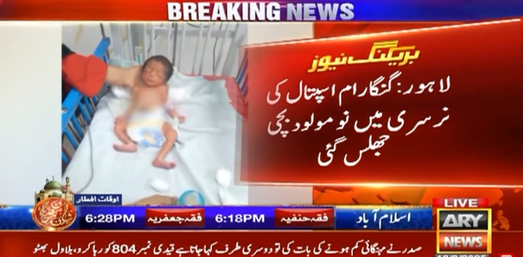 انتظامیہ کی مبینہ غفلت سے نومولود بچی جھلس گئی، مریم نواز سے انصاف کی اپیل