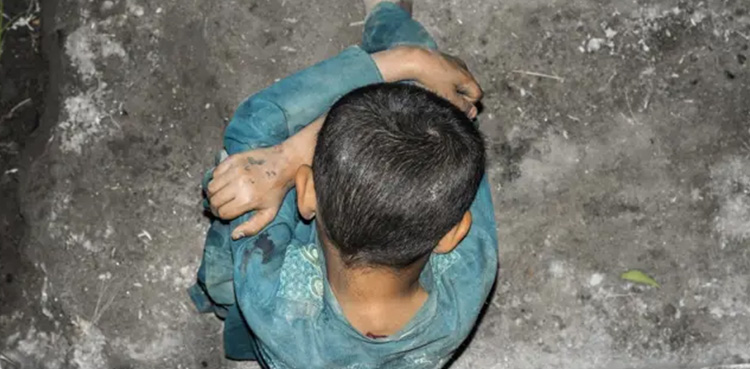 12سالہ گھریلو ملازم بچے پر حیوانی تشدد، جلانے، کاٹنے، استری سے داغنے کے نشانات