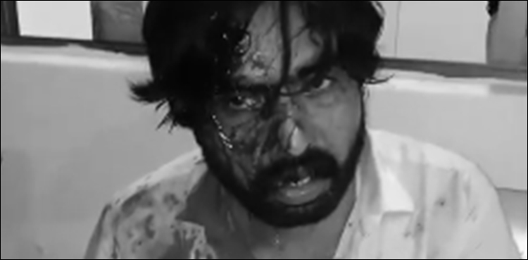 ڈیفنس میں ہوٹل ملازمین نے پولیس اہلکار اور شہری کو بد ترین تشدد کا نشانہ بنا دیا