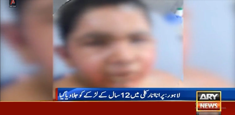 لاہور میں کم عمر لڑکے کو معمولی تنازع پر جلا دیا گیا