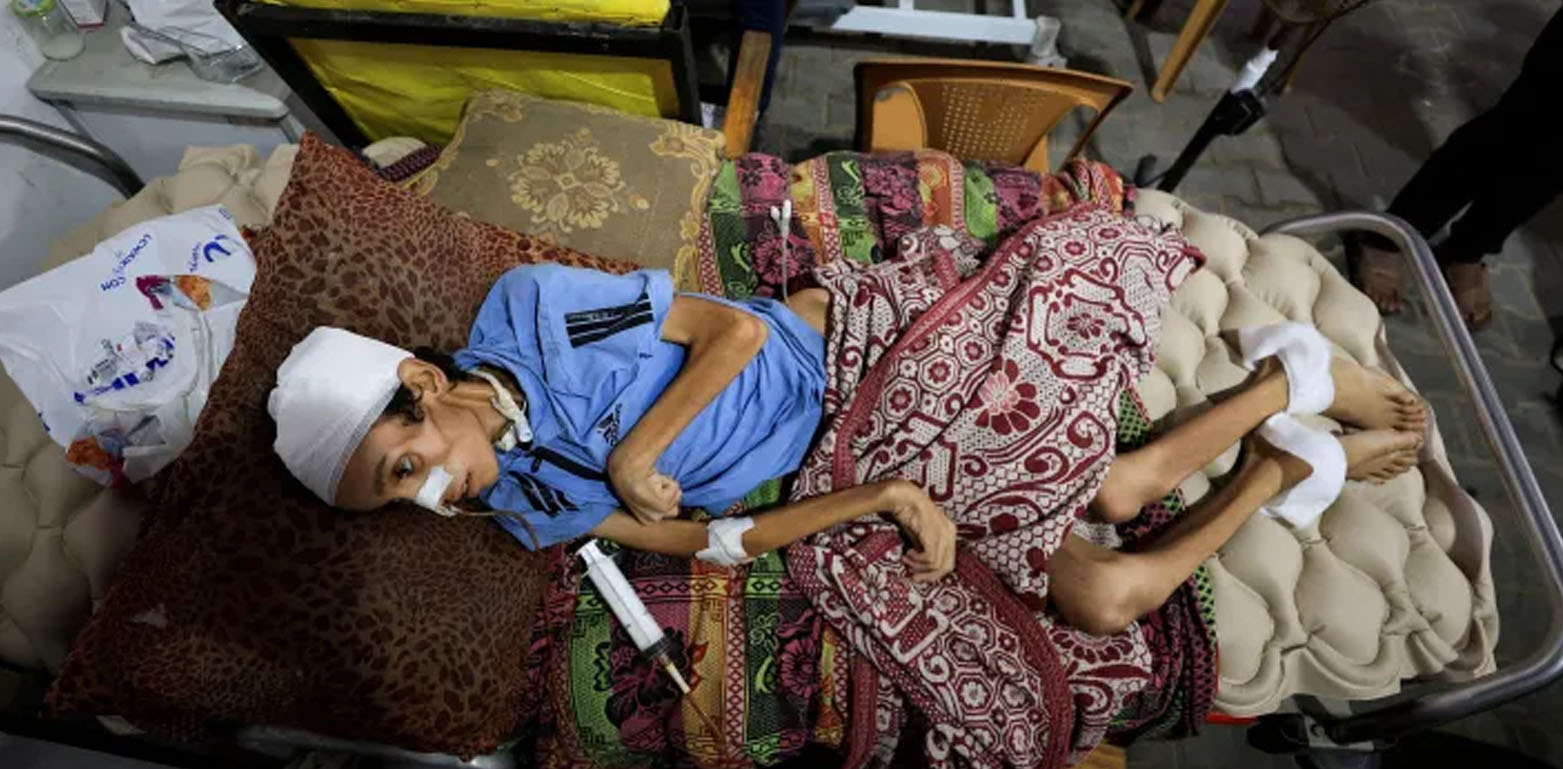 غزہ میں غذائی قلت سے مزید 7 افراد جاں بحق، مجموعی تعداد 154 ہو گئی