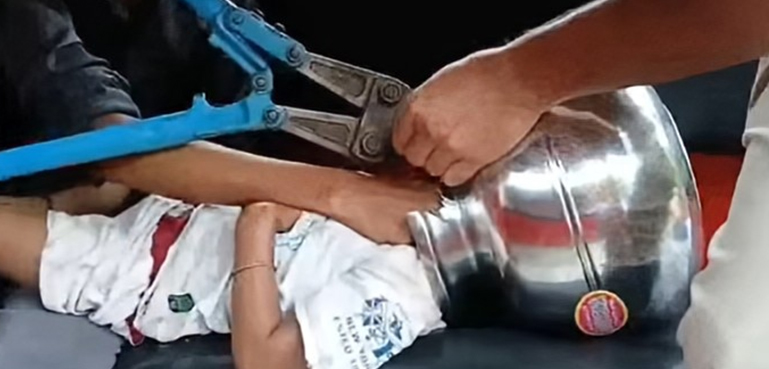 کھیل ہی کھیل میں بچے کا سر برتن میں پھنس گیا (خوفناک ویڈیو)