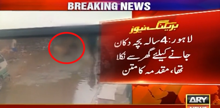 کتے کا 4 سالہ بچے پر حملہ